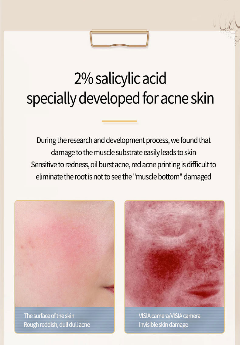 Ansiyi Acne Removing Salicylic  Acid Serum
