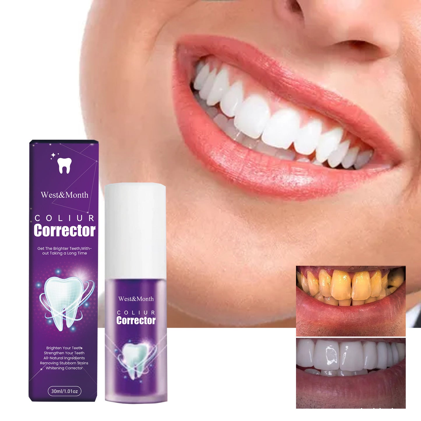 Whitening Toothpaste